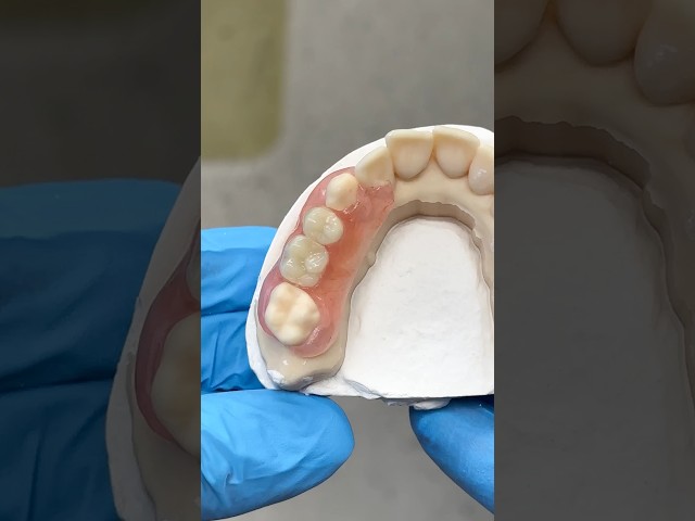 Double Nesbit #lsk121shorts #dental #teeth