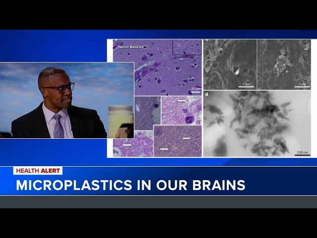 Dr. Sutton discusses new microplastic study in Q&A