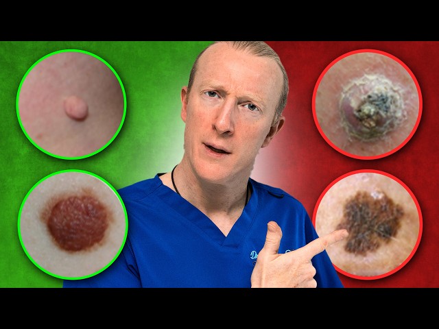 Innocent Skin Lesion or Skin Cancer: How to Differ? (Safe Skin System)