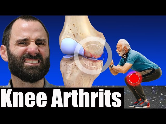 Managing Knee Osteoarthritis: Top Strategies for Pain Relief and Joint Health