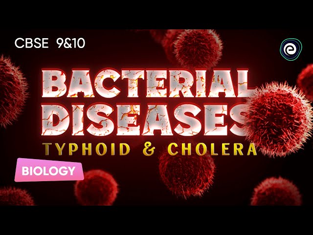 Bacterial Diseases: Typhoid and Cholera | Biology | CBSE Class 9&10 | Embibe: Achieve Class 9&10