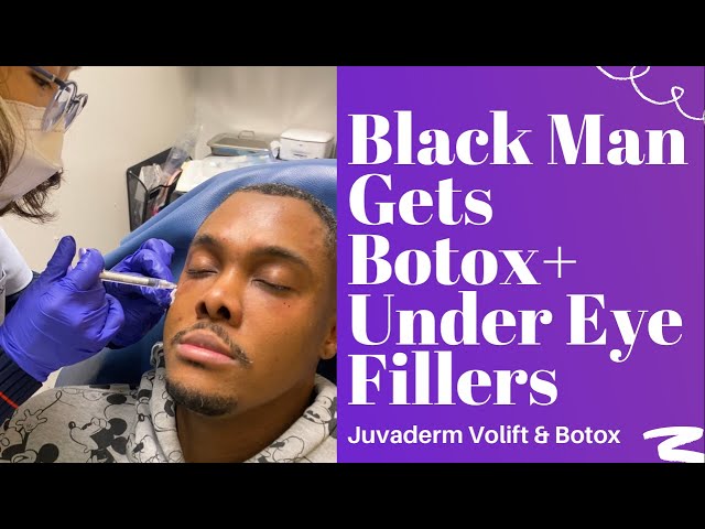 Black Man Gets Botox And Under Eye Fillers