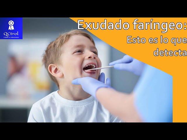 What is the pharyngeal exudate? Discover the usefulness of this test