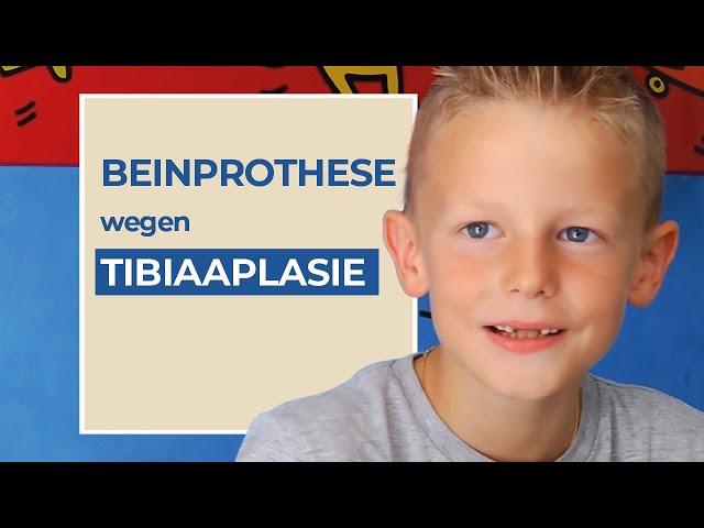 Moritz' Weg mit Tibiaaplasie (Dysmelie): Orthoprothese, Knieex-Prothese, Badeprothese