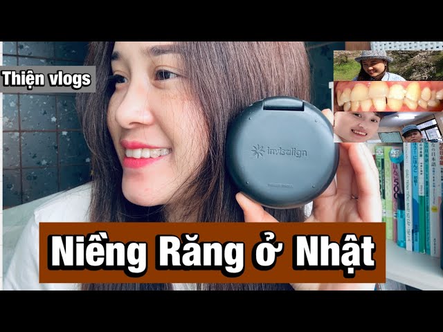 Niềng răng tại nhà ở Nhật có hiệu quả không?!|Niềng răng hô hết bao nhiêu tiền?|#79