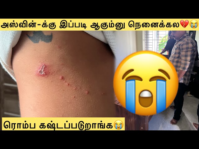 💔😭அஸ்வின்-க்கு இப்படி ஆகும்னு நெனைக்கல😭ரொம்ப கஷ்டப்படுறாங்க🥺😭#aswincharu #trending #youtube #love