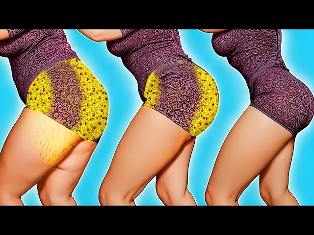 HIP FAT WORKOUT | SHAPE YOUR LOWER BODY | GET CELLULITE FREE LEGS