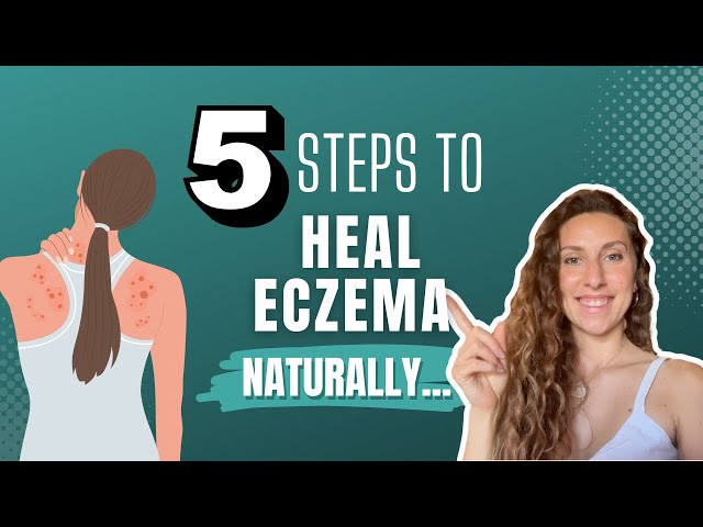 Sick of The Itch? 5 Steps To Heal Eczema Naturally