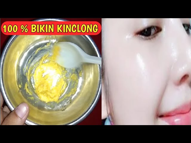 100 % BERHASIL !! OLES MASKER INI KE WAJAH || FLEK-FLEK HITAM DEKIL TEBAL DI WAJAH RONTOK PERMANEN