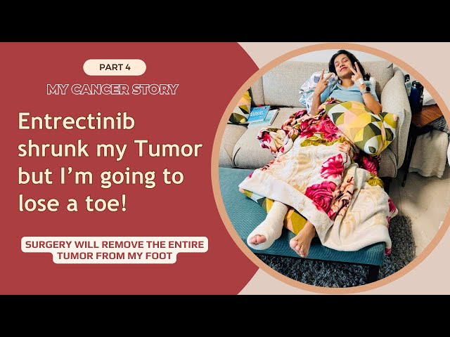 Entrectinib Shrunk my Tumor in Less than 3 Weeks! (Shocking MRI Update)