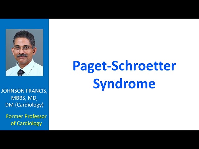 Paget-Schroetter Syndrome