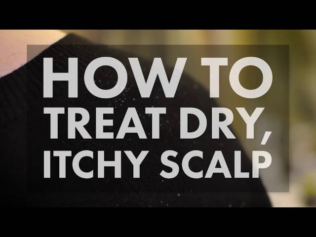 How to Treat a Dry, Itchy Scalp | WebMD