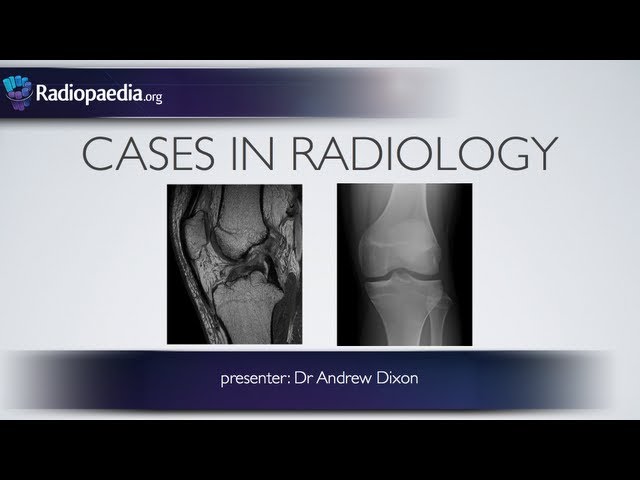 Cases in Radiology: Episode 4 (musculoskeletal, MRI, x-ray)