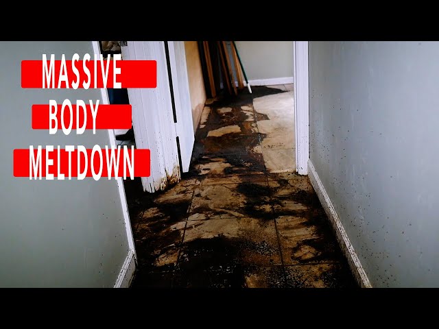 Massive Body Meltdown | Naples, FL