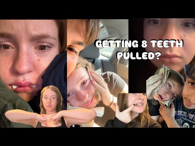 getting 8 teeth pulled?? - invisalign journey