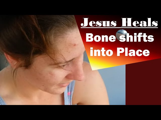 Jesus Heals: broken bone and cast out demons