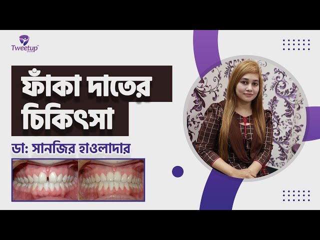 ফাঁকা দাঁতের চিকিৎসা । । Treatment of Hollow Teeth