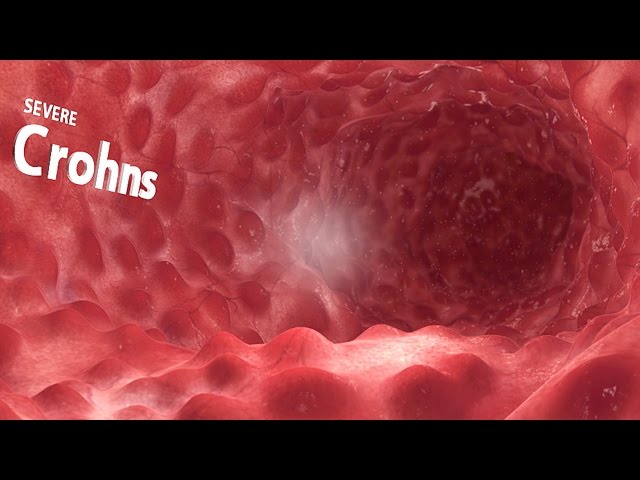 360° VR animation | inside the GI tract