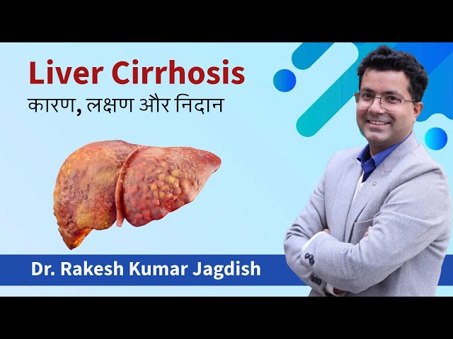 Liver cirrhosis - Warning Signs,  Cirrhosis: An Underappreciated Public Health Challenge