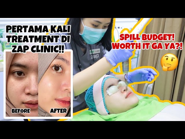 REVIEW TREATMENT DI ZAP CLINIC!! DNA SALMON MICRO INJECTION - SPILL BUDGET DAN HASILNYA ‼️