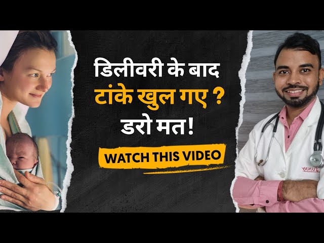 normal delivery ke tanke khul jaaye to kya karen | नॉर्मल डिलीवरी के टांके टूट जाए तो क्या करें