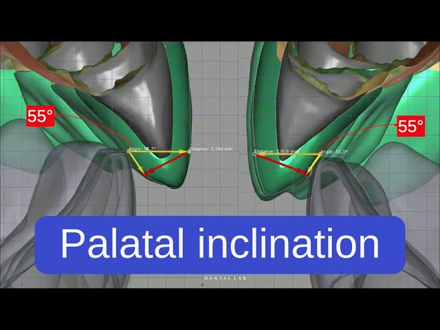 How the palatal angle affects tooth function