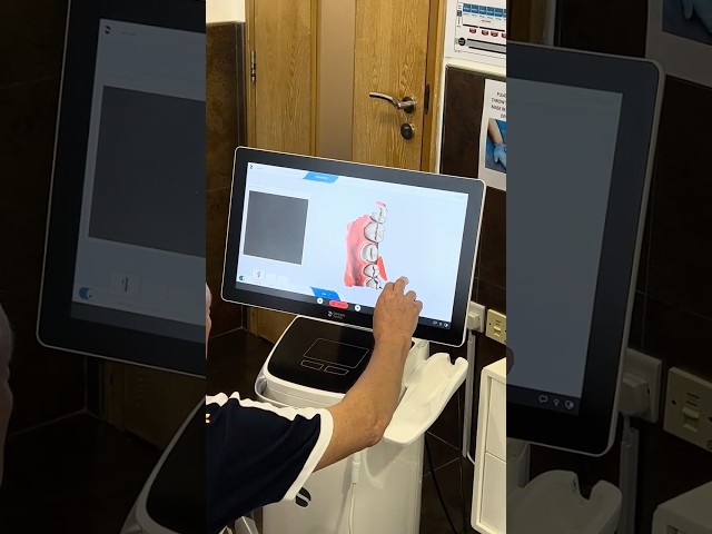 Dental Scan Demo on Model