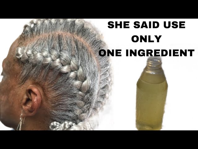 I'M SHOCKED! 100,000 PEOPLE TRIED THIS HAIR GROWTH RECIPE AND THIS HAPPENED!GROW YOUR HAIR THICKER