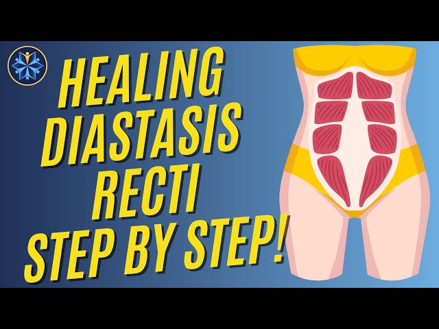 Healing Diastasis Recti: Simple Movements for Recovery