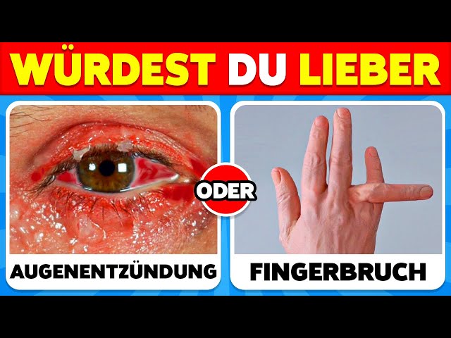 Würdest Du Lieber...? 250 SCHWERSTE Entscheidungen aller Zeiten! 😱😨