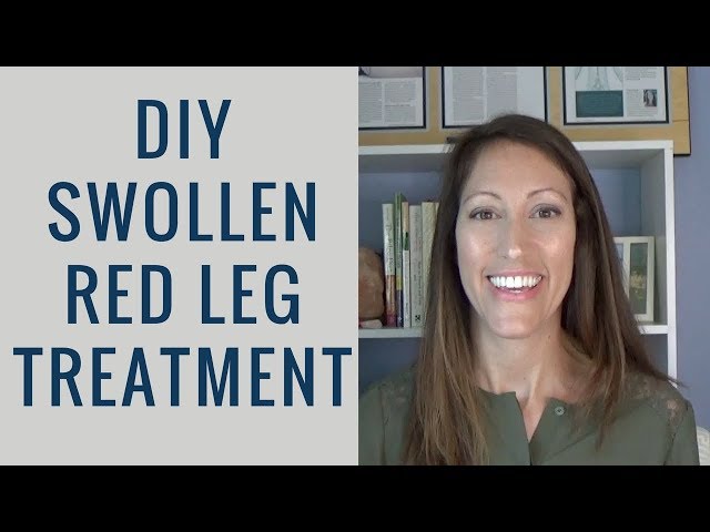 How to Reduce Swollen and Red Legs, Feet and Ankles | Lymphedema from Chronic Venous Insufficiency