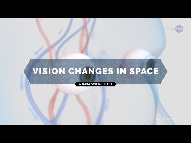 NASA ScienceCasts: Vision Changes in Space