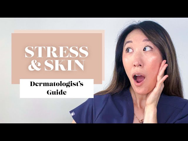 Dermatologist Explains Stressed Skin - How to Manage Acne Flares and Other Conditions