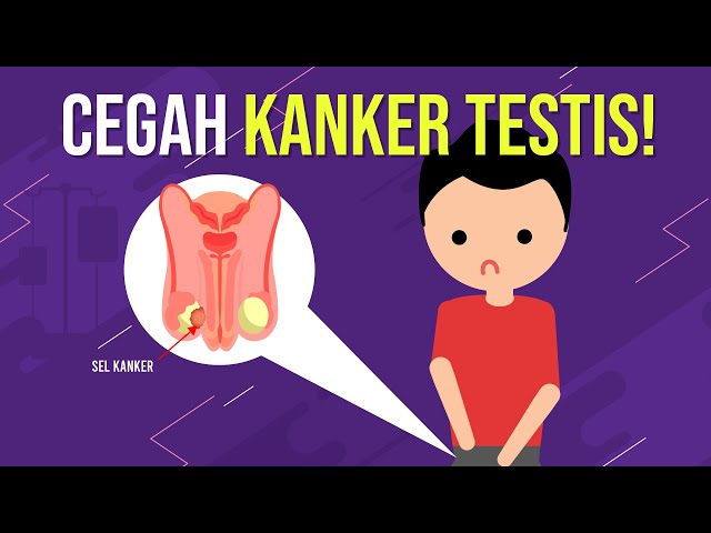 Cara Mencegah Kanker Testis!