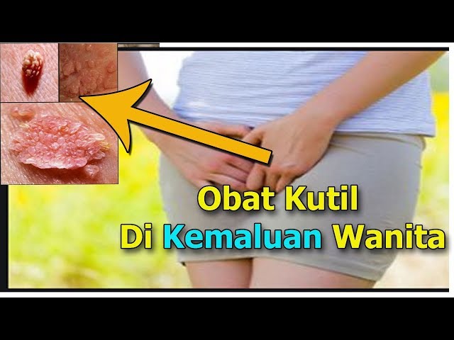 Cara Menyembuhkan Kutil Kelamin Dengan Obat Kutil Di Kemaluan Wanita