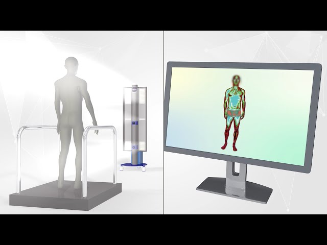 CryoVizion imaging system   Postural assessment