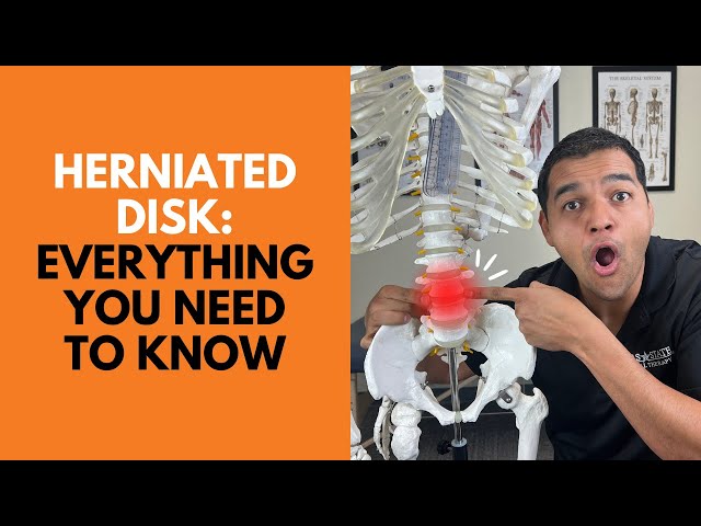 Herniated Disk Everything You Need To Know To Get Better Without Surgery