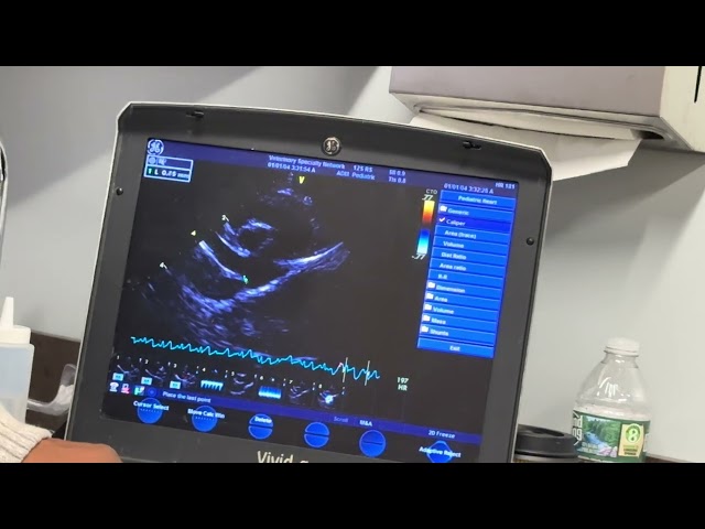 Learn about Echocardiogram for puppy with pda