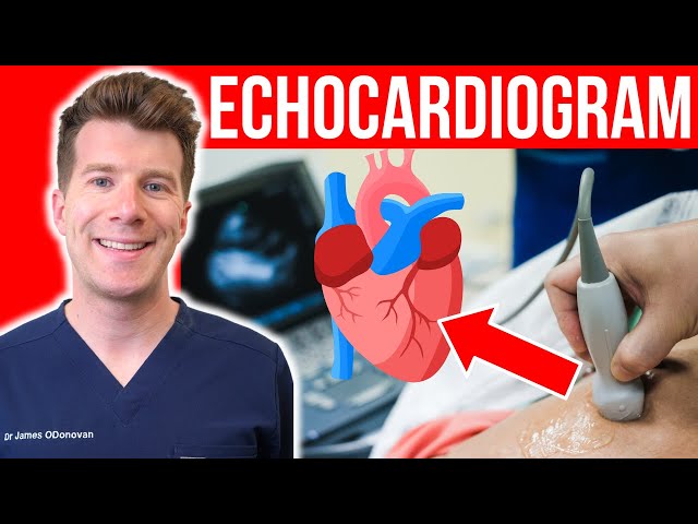 Doctor explains Echocardiogram Heart Test | Everything you need to know