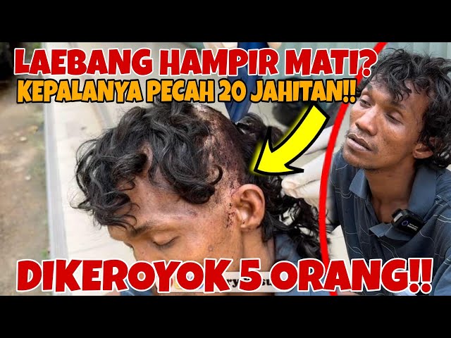 LAEBANG DIKEROYOK HAMPIR MATI KEPALANYA DIJAHIT 20 JAHITAN ⁉️