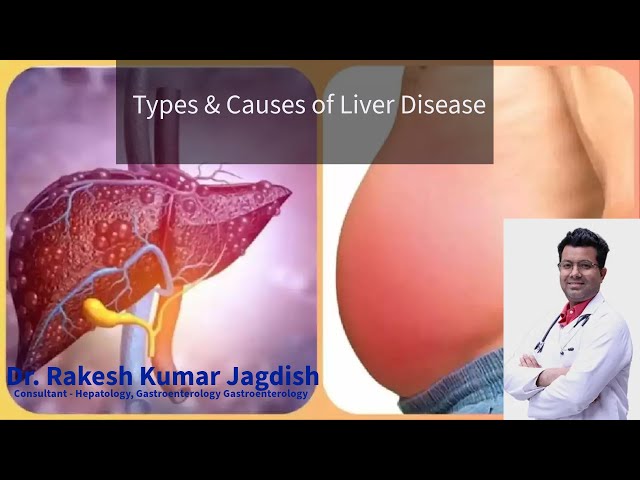 Types & Causes of Liver Disease by Dr Rakesh Kumar  Jagdish #liverdiseaseawareness #liverhealth #rkj