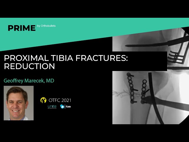 Proximal Tibia Fractures: Reduction - Geoffrey Marecek, MD