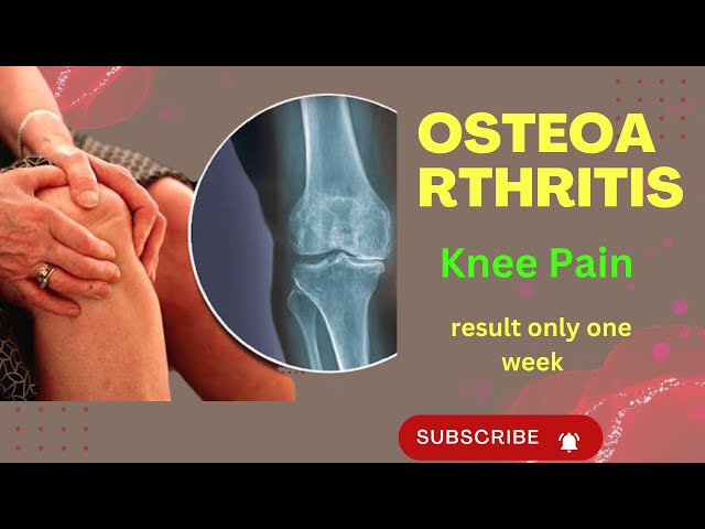 80 years Old Men Bend Knee Osteoarthritis | knee osteoarthritis exercises