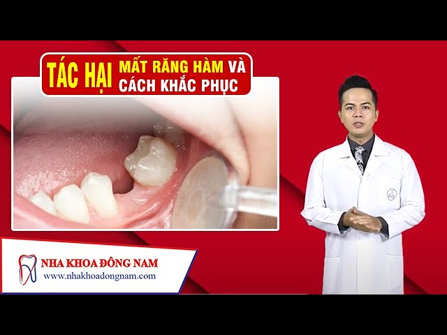 Tác Hại Của Việc Mất Răng Hàm Và Cách Khắc Phục | NHA KHOA ĐÔNG NAM®