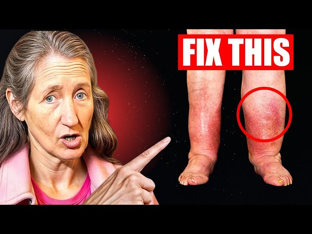 Barbara O’Neill Exposes the TRUTH 15 Years of Swollen Legs Gone Instantly!