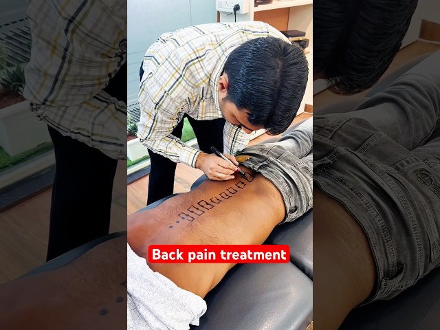 Back pain treatment #trend #feed #backpainrelief #ytshort