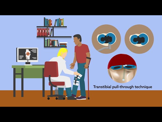 Repair of medial meniscus root tear could prevent progression to arthritis and knee arthroplasty