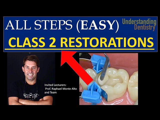 How to do Composite Restoration (Class 2 composite restoration lecture, proximal caries restoration)