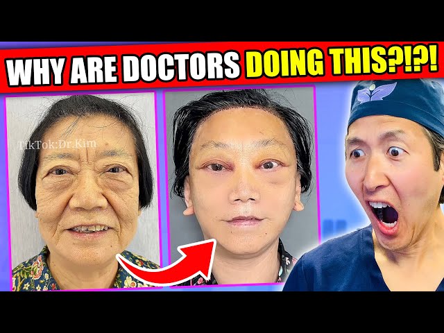 EXTREME Asian Plastic Surgery TikToks! WHY???