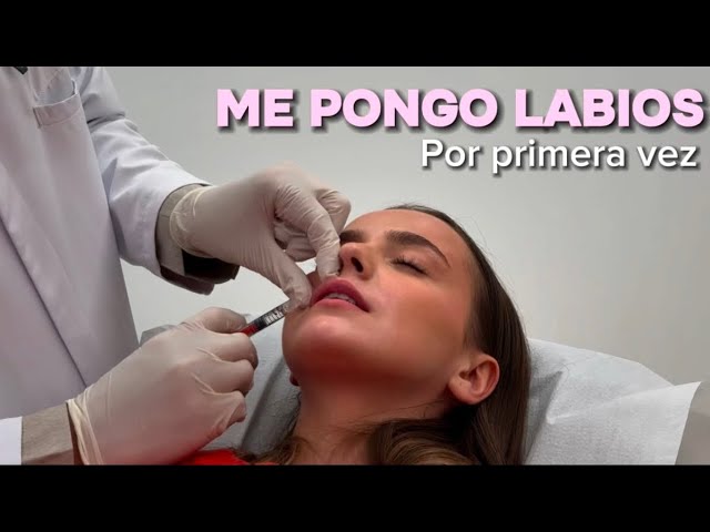 ME PONGO LABIOS POR PRIMERA VEZ| viaje a Barcelona, proceso, RESULTADO y evolución